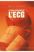 Lecture acceleree de l'ecg, 6e ed.